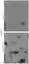 Fig. 15 - CRYSTALLINE FORMS OF A BILE ACID DERIVATIVE