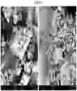Fig. 16 - CRYSTALLINE FORMS OF A BILE ACID DERIVATIVE