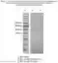 Fig. 07 - CELL-TARGETING MOLECULES COMPRISING DE-IMMUNIZED, SHIGA TOXIN A SUBUNIT EFFECTORS AND CD8+ T-CELL EPITOPES