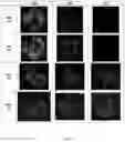 Fig. 02 - RECOMBINANT POLYPEPTIDE-ENRICHED CHLOROPLASTS OR ACCUMULATED LIPID PARTICLES AND METHODS FOR PRODUCING THE SAME IN ALGAE