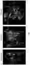 Fig. 03 - TNF-TYPE RECEPTOR-LIGAND FUSION PROTEINS AND METHODS