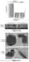 Fig. 02 - Methods of treating cancer using anti-LRP1 polyclonal antibodies