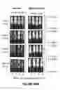 Fig. 164 - Chimeric antigen receptors (CARs), compositions and methods thereof