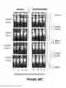Fig. 165 - Chimeric antigen receptors (CARs), compositions and methods thereof