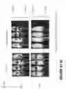 Fig. 182 - Chimeric antigen receptors (CARs), compositions and methods thereof