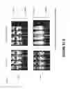 Fig. 184 - Chimeric antigen receptors (CARs), compositions and methods thereof