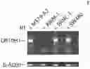 Fig. 01 - OR10H1 ANTIGEN BINDING PROTEINS AND USES THEREOF