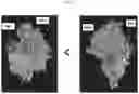 Fig. 04 - Antibodies that bind human CD39 and inhibit ATPase activity of a soluble extracellular domain human CD39 polypeptide
