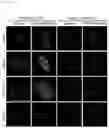 Fig. 12 - Antibody binding specifically to MUC1 and use thereof