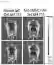 Fig. 18 - Antibody binding specifically to MUC1 and use thereof