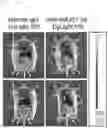 Fig. 22 - Antibody binding specifically to MUC1 and use thereof
