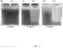 Fig. 04 - Methods and treatment fluids for microfracture creation and microproppant delivery in subterranean formations