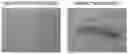 Fig. 01 - METHOD FOR SEPARATING MEGAKARYOCYTES AND PLATELETS, AND PLATELET SEPARATION KIT