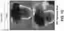 Fig. 03 - CHEMICAL DIFFERENTIATION OF PLURIPOTENT STEM CELLS INTO RETINAL EPITHELIAL CELLS