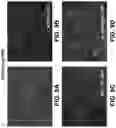 Fig. 11 - CHEMICAL DIFFERENTIATION OF PLURIPOTENT STEM CELLS INTO RETINAL EPITHELIAL CELLS