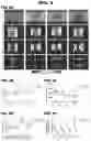 Fig. 10 - CARDIAC TISSUE MODELS AND METHODS OF USE THEREOF
