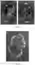 Fig. 08 - Methods and compositions for vault nanoparticle immobilization of therapeutic molecules and for vault targeting