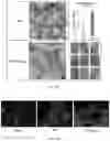 Fig. 14 - Methods and compositions for vault nanoparticle immobilization of therapeutic molecules and for vault targeting