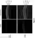 Fig. 07 - Methods and compositions for treating Leber congenital amaurosis