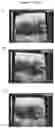 Fig. 15 - Exosomes and micro-ribonucleic acids for tissue regeneration