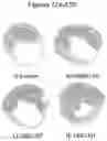 Fig. 16 - Exosomes and micro-ribonucleic acids for tissue regeneration