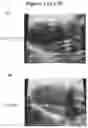Fig. 22 - Exosomes and micro-ribonucleic acids for tissue regeneration