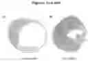 Fig. 23 - Exosomes and micro-ribonucleic acids for tissue regeneration