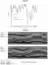 Fig. 06 - Recombinant adeno-associated virus capsids with enhanced human pancreatic tropism