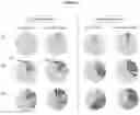Fig. 12 - Recombinant adeno-associated virus capsids with enhanced human pancreatic tropism
