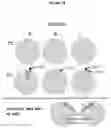 Fig. 15 - Recombinant adeno-associated virus capsids with enhanced human pancreatic tropism