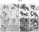 Fig. 24 - Recombinant adeno-associated virus capsids with enhanced human pancreatic tropism