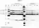 Fig. 42 - Recombinant adeno-associated virus capsids with enhanced human pancreatic tropism