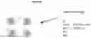 Fig. 43 - Recombinant adeno-associated virus capsids with enhanced human pancreatic tropism