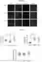 Fig. 58 - Recombinant adeno-associated virus capsids with enhanced human pancreatic tropism