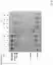 Fig. 21 - Method for producing RNA