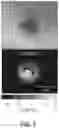 Fig. 04 - Methods and systems of characterizing and counting microbiological colonies
