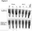 Fig. 07 - Use of anticoagulants in the polymerase chain reaction