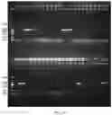 Fig. 09 - PCR detection kit for rapidly identifying of specific serotypes