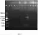 Fig. 13 - PCR detection kit for rapidly identifying of specific serotypes