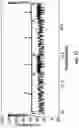 Fig. 28 - Hairpin loop method for double strand polynucleotide sequencing using transmembrane pores