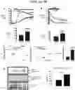 Fig. 04 - TRPC6 involved in glomerulonephritis