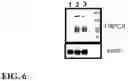 Fig. 07 - TRPC6 involved in glomerulonephritis