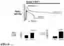 Fig. 09 - TRPC6 involved in glomerulonephritis