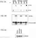 Fig. 04 - Treatment of cancers having mutations of the PIK3CA gene