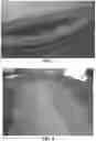Fig. 08 - BIO-DEGRADABLE COMPOSITION AND/OR PROBIOTIC BIOCHEMICALS AND METHODS OF USE IN LEATHER TANNING PROCESSES