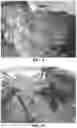 Fig. 09 - BIO-DEGRADABLE COMPOSITION AND/OR PROBIOTIC BIOCHEMICALS AND METHODS OF USE IN LEATHER TANNING PROCESSES