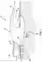 Fig. 02 - APPARATUS FOR REMOVING SURFACE POLLUTANTS AND BOTTOM MUCK FROM A BODY OF WATER