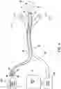 Fig. 07 - APPARATUS FOR REMOVING SURFACE POLLUTANTS AND BOTTOM MUCK FROM A BODY OF WATER
