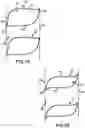 Fig. 10 - Covering for architectural openings with coordinated vane sets