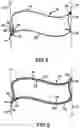 Fig. 11 - Covering for architectural openings with coordinated vane sets